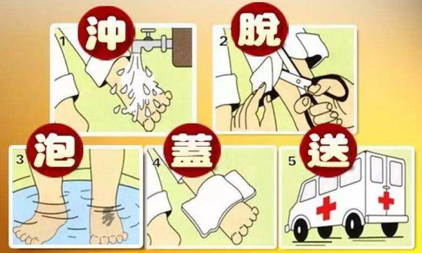 烧伤烫伤急救,重庆康华医院护理常识