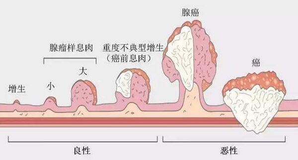 体检结果异常,重庆康华医院体检中心