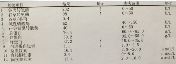 肝功能检查化验单,重庆康华医院体检中心