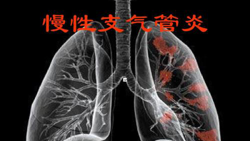 慢性支气管炎的防治,重庆康华医院内科