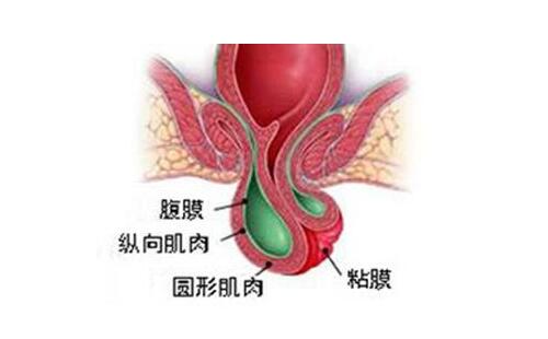 脱肛的治疗,重庆康华医院肛肠外科