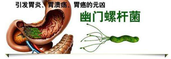 重庆康华医院早期胃癌筛查